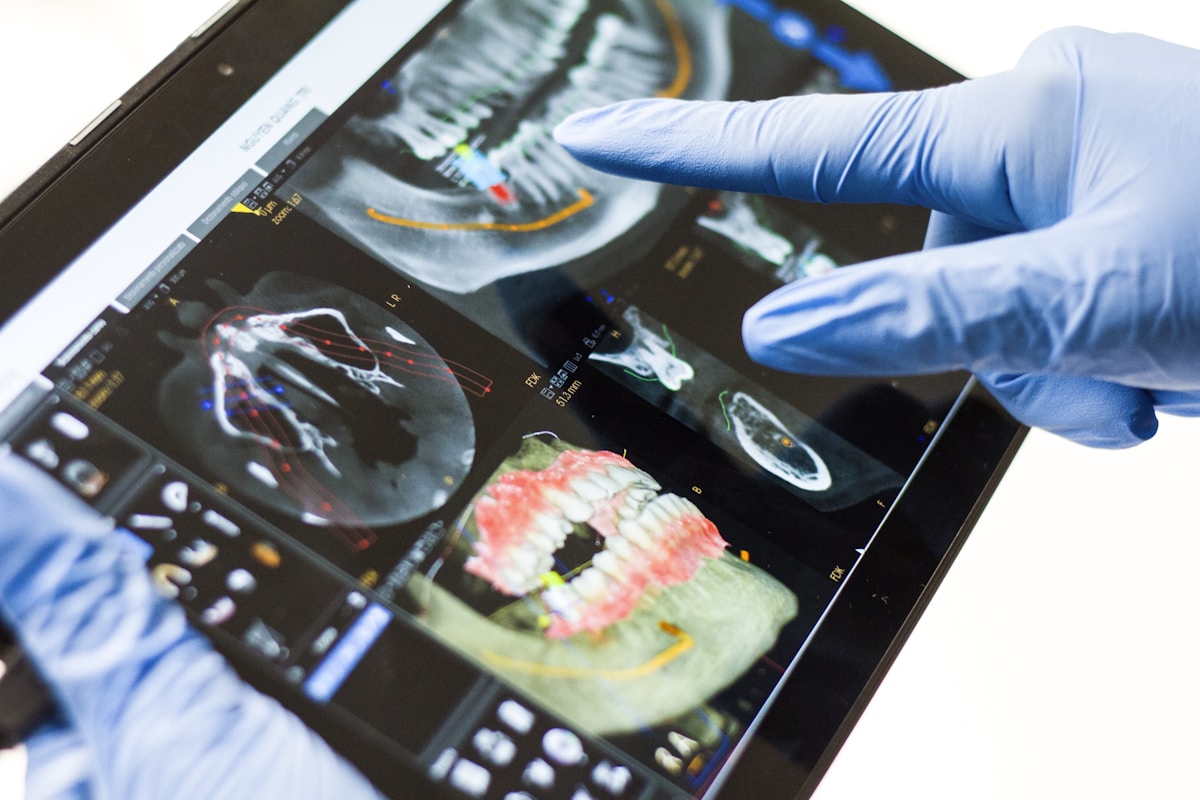 CT・3D画像で顎の骨の状態を確認する歯科医師